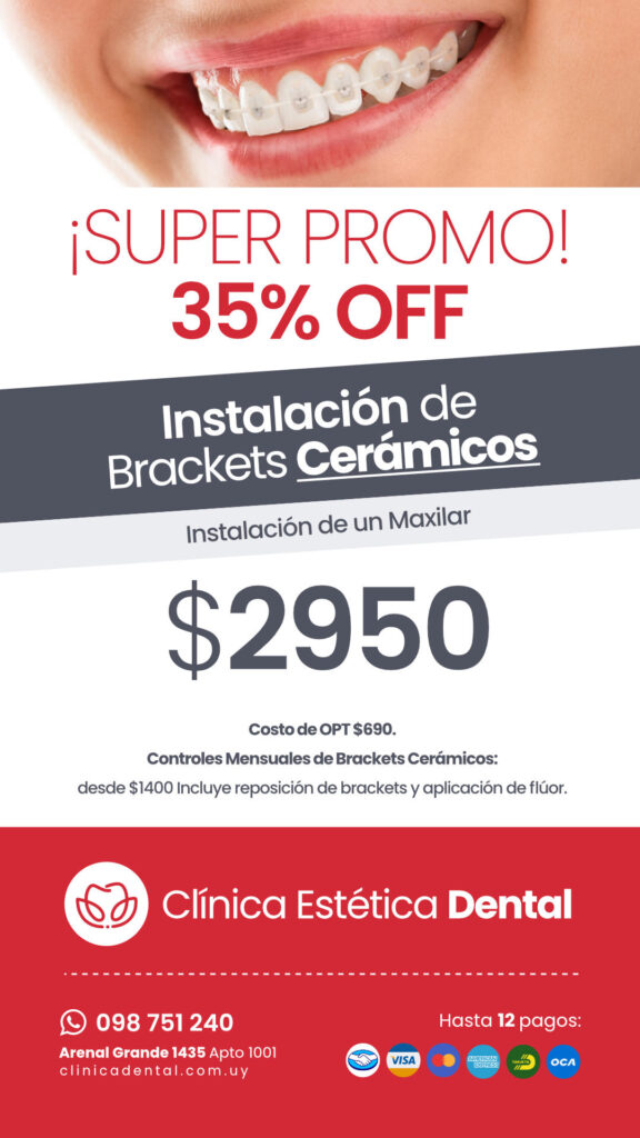 promo2