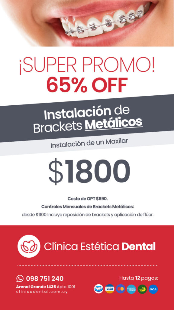 promo3